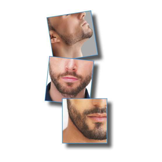 Barbero Babyliss E846E